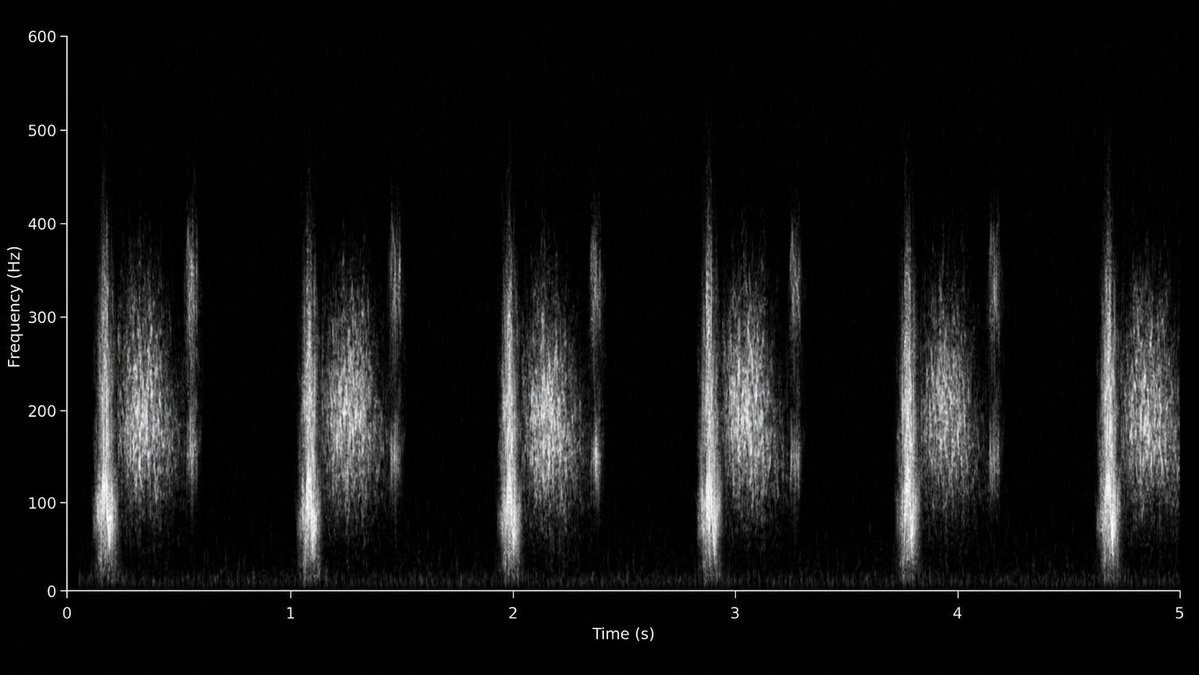 Aortic Stenosis Spectrogram Generation preview image